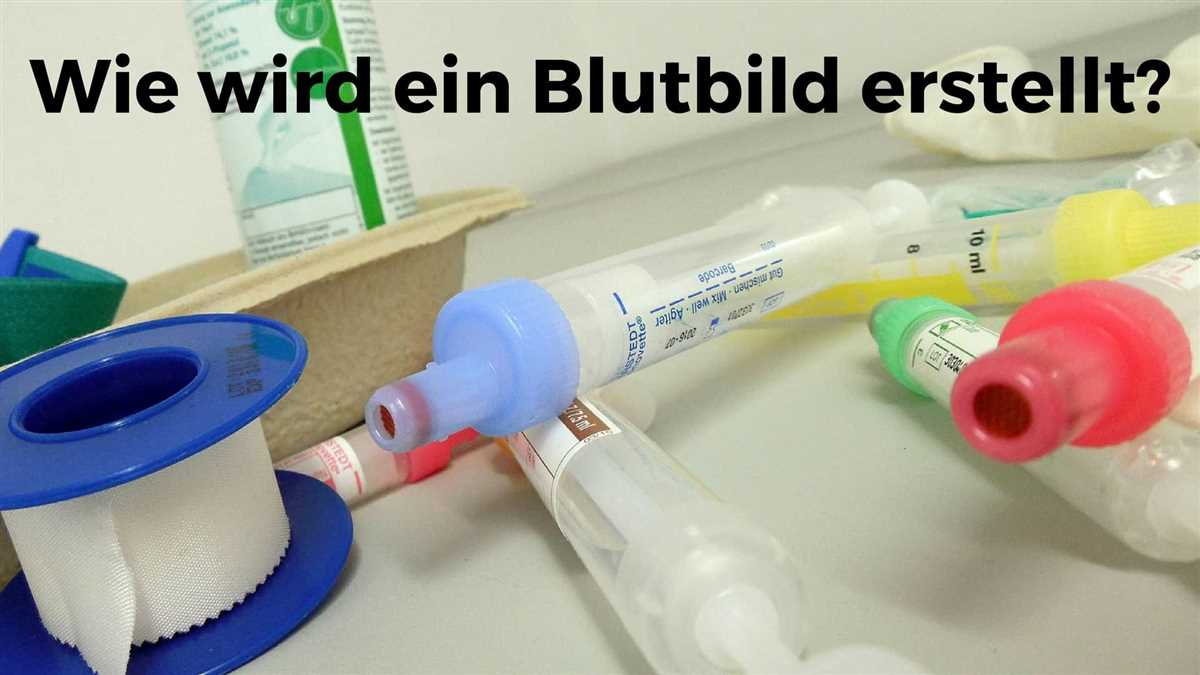 Was ist ein großes Blutbild?