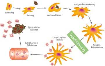 Was ist eine dendritische Zelltherapie?